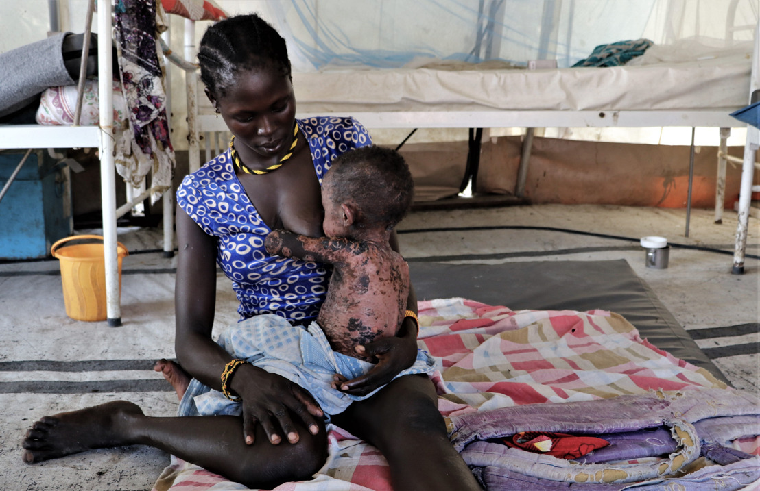 South Sudan: Urgent vaccination campaign needed to stop spread of measles