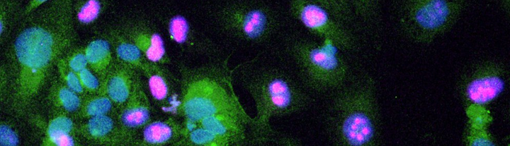 Endothelial cells in vitro - dapi blue + Ki67 magenta + TRAIL green - to send.jpg