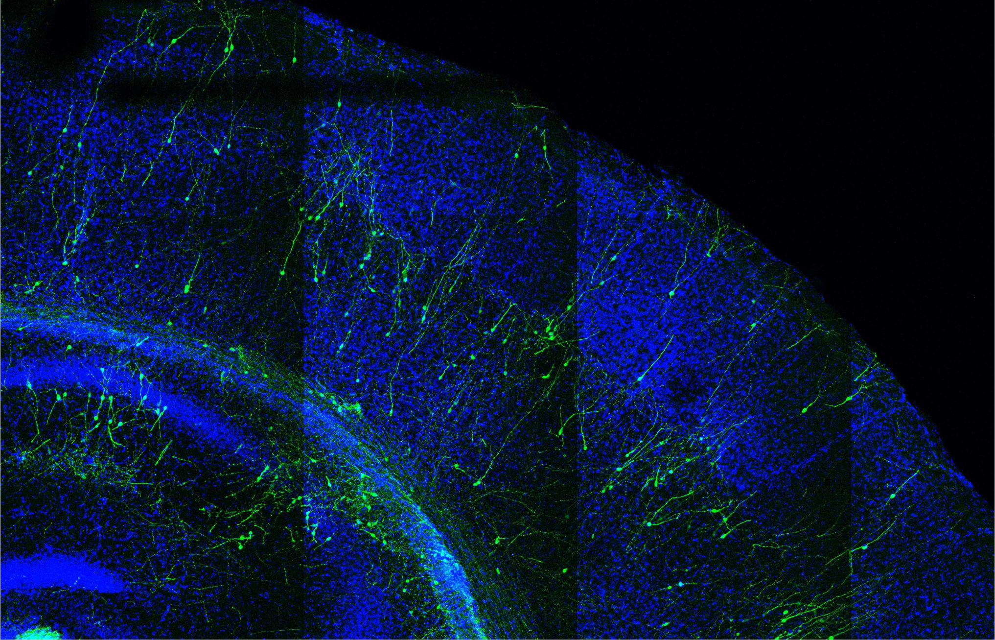 Cortex de souris (en bleu) transplanté avec des neurones humains (en vert)