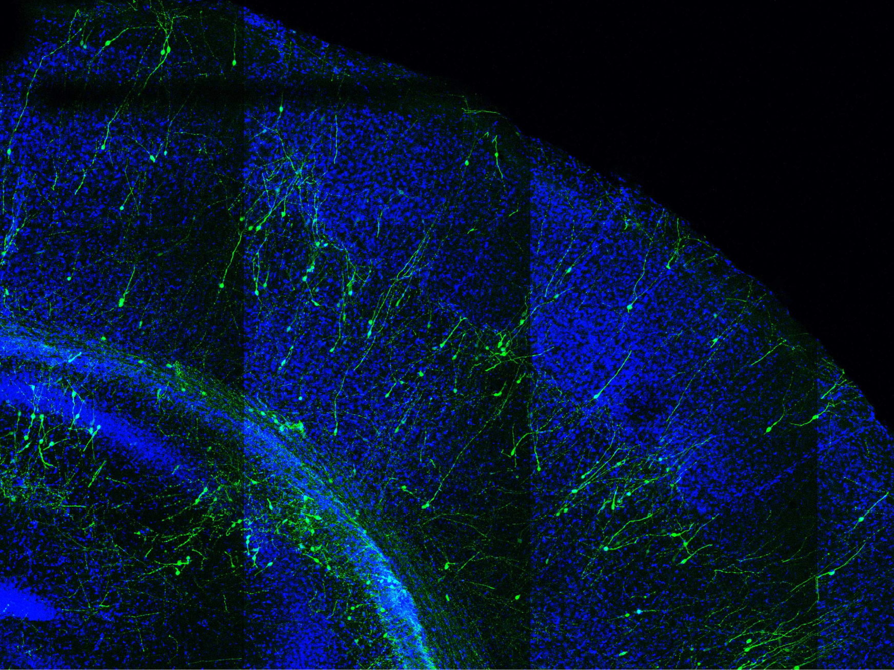Une nouvelle étude relie le développement prématuré des neurones humains à certaines maladies du développement du cerveau