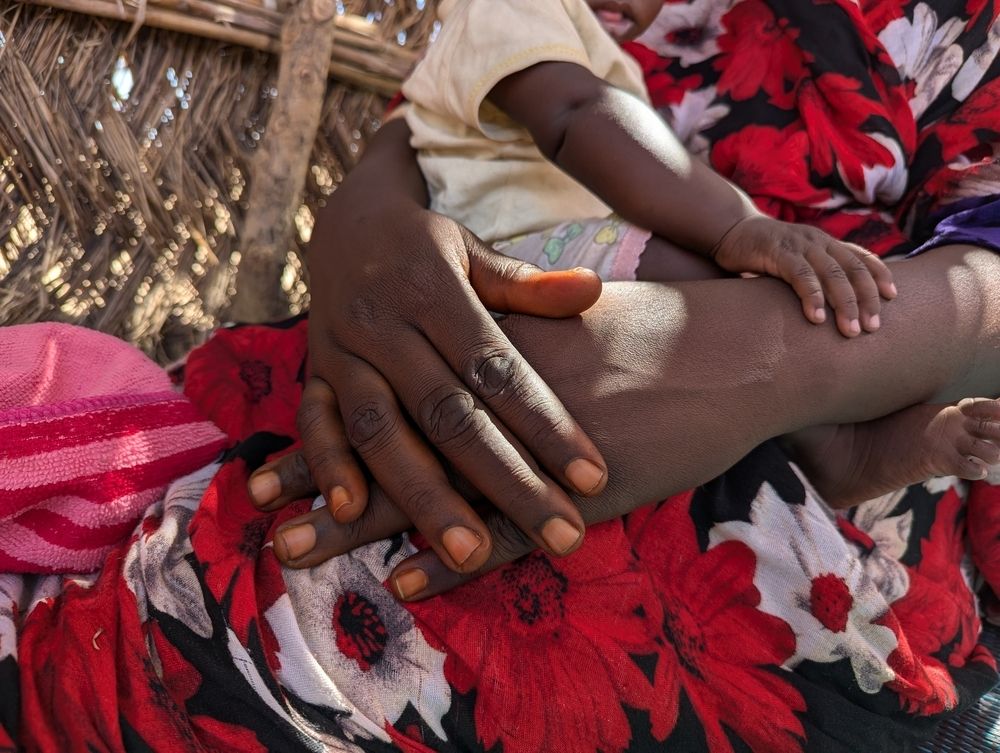 Copyright: MSF Copyright: MSF