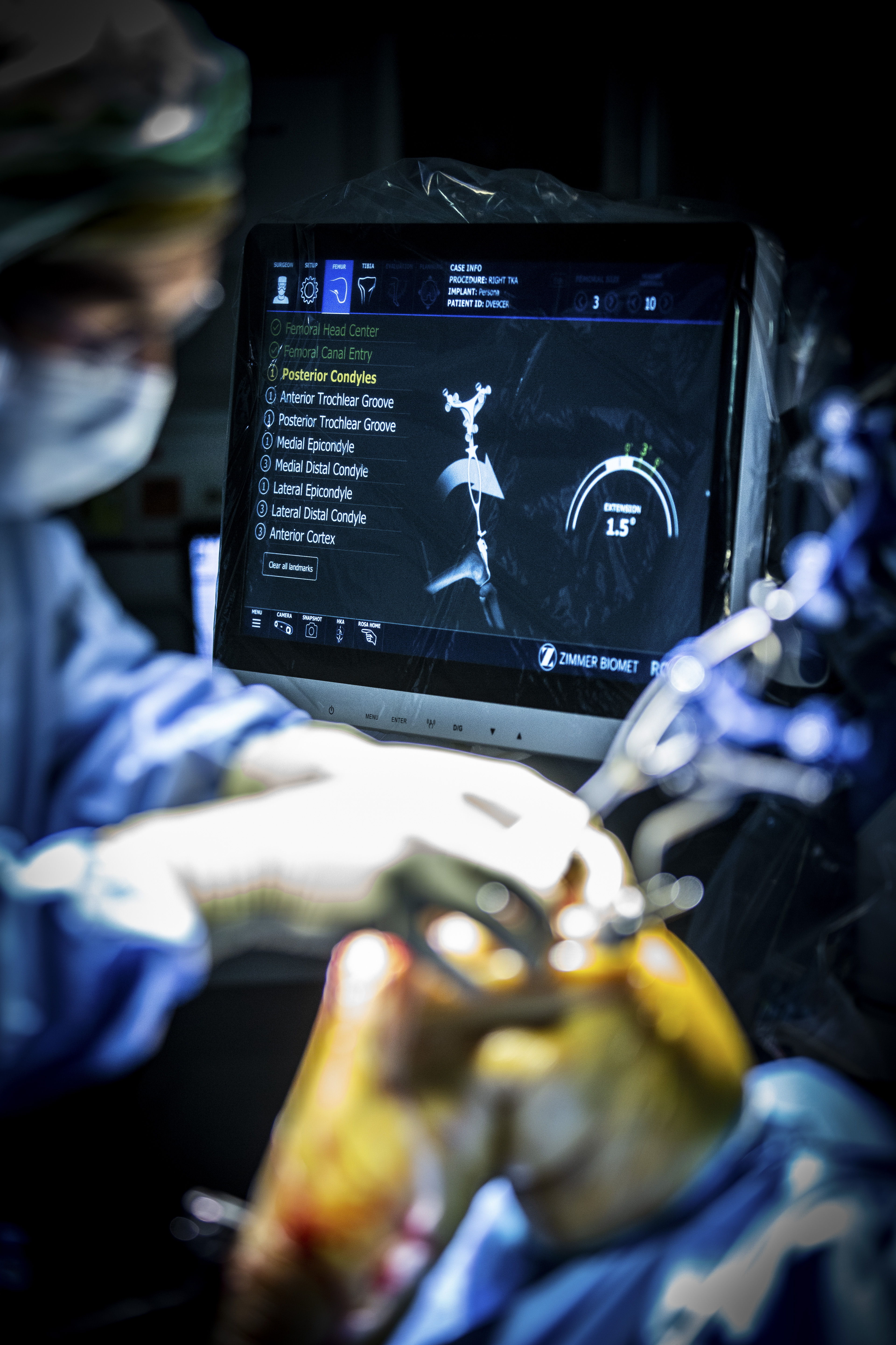 De ROSA-robot helpt met het opmeten van de knie bij de plaatsing van een knieprothese. (Foto: ZNA / Dirk Kestens)