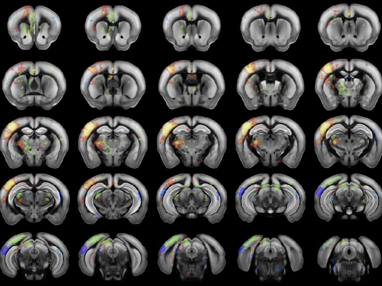 Peering into the brain with ultrasound