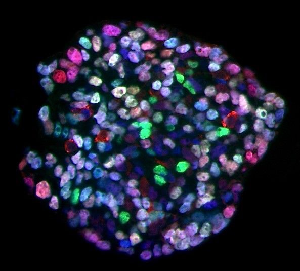 Cel cluster met pancreas progenitor cellen gedevieerd van human stam cellen in het laboratorium