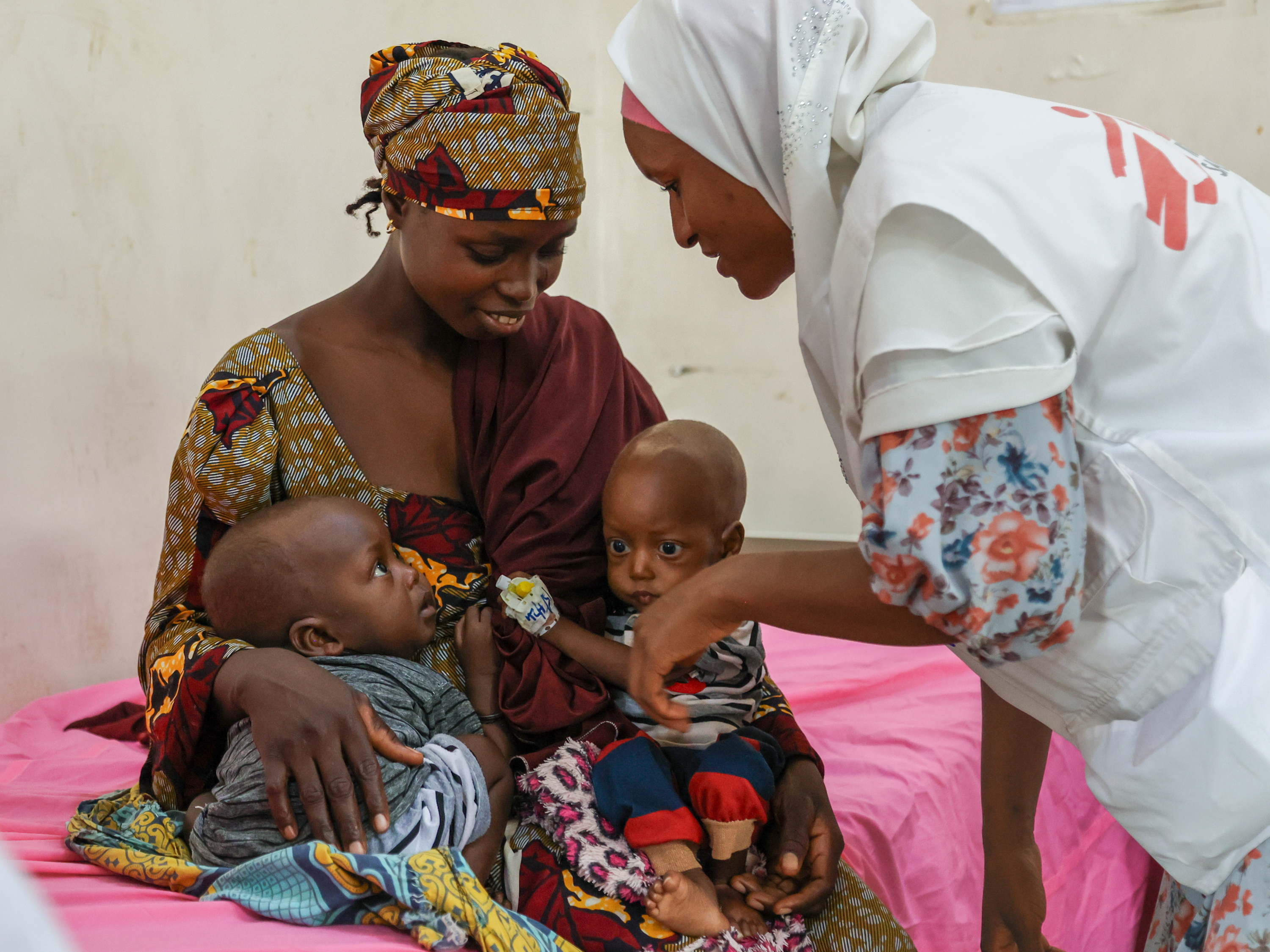 Nigeria: la desnutrición infantil aumenta de forma abrumadora en el norte del país