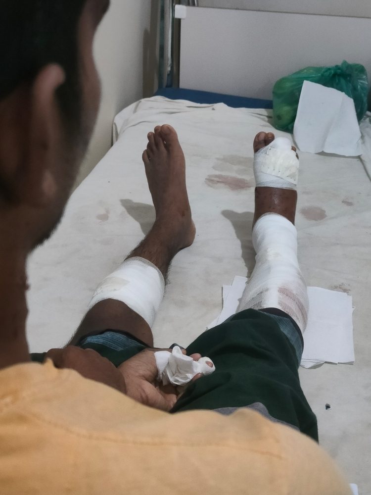 Un rohinya superviviente de la explosión de una bomba recibe tratamiento en las instalaciones de MSF.  © Mohammad Sazzad Hossain 