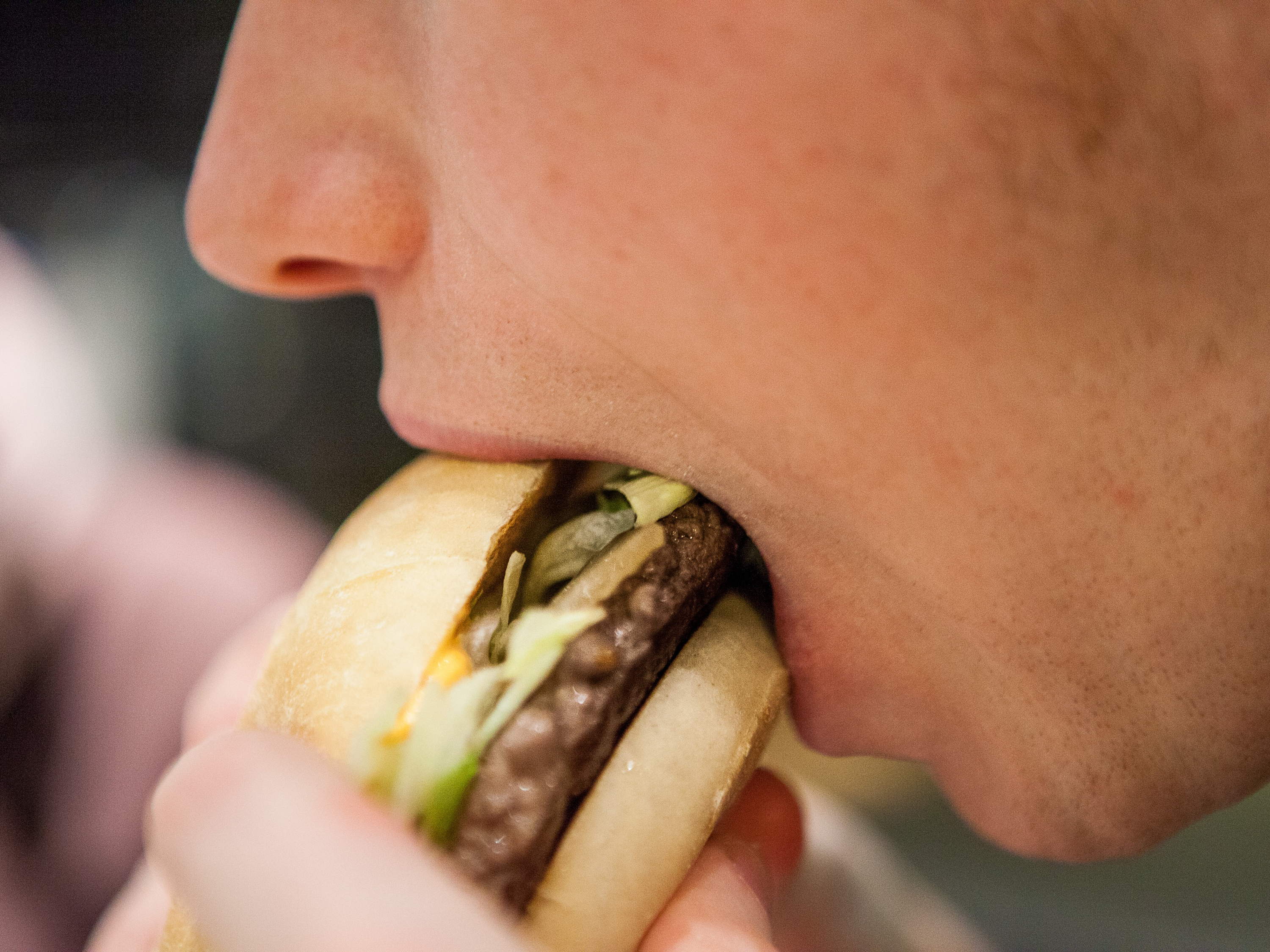 More children are obese than underweight, Unicef warns