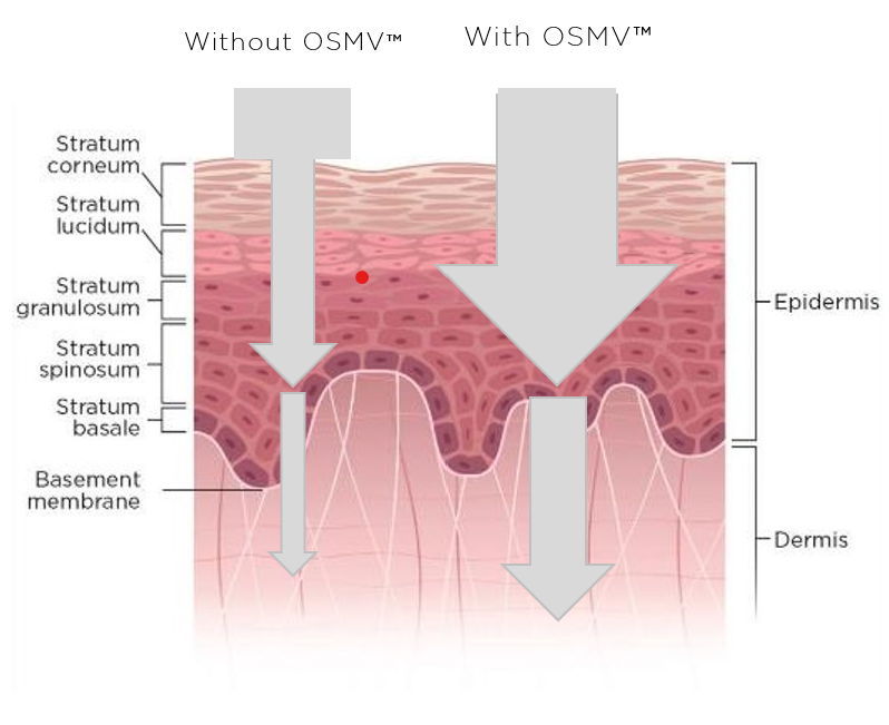 Increased and Sustained Penetration with OSMV