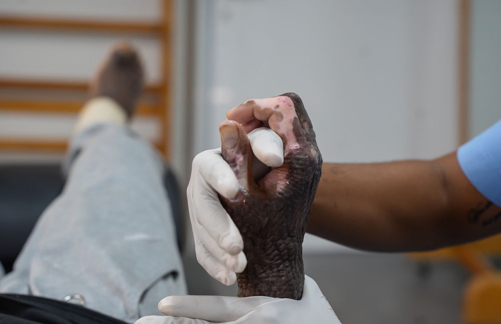 Copyright: MSF/Marx Stanley Léveillé Copyright: MSF/Marx Stanley Léveillé