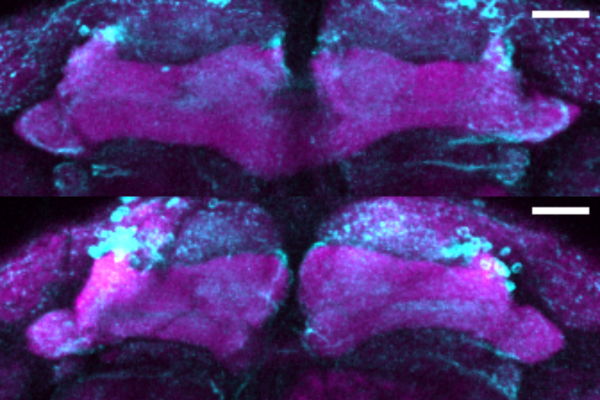 Synapse loss can be observed in aged mutant flies (top image) compared to controls (bottom image)