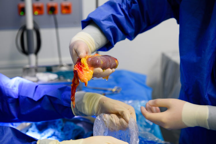 Niertransplantatie (UZ Leuven)