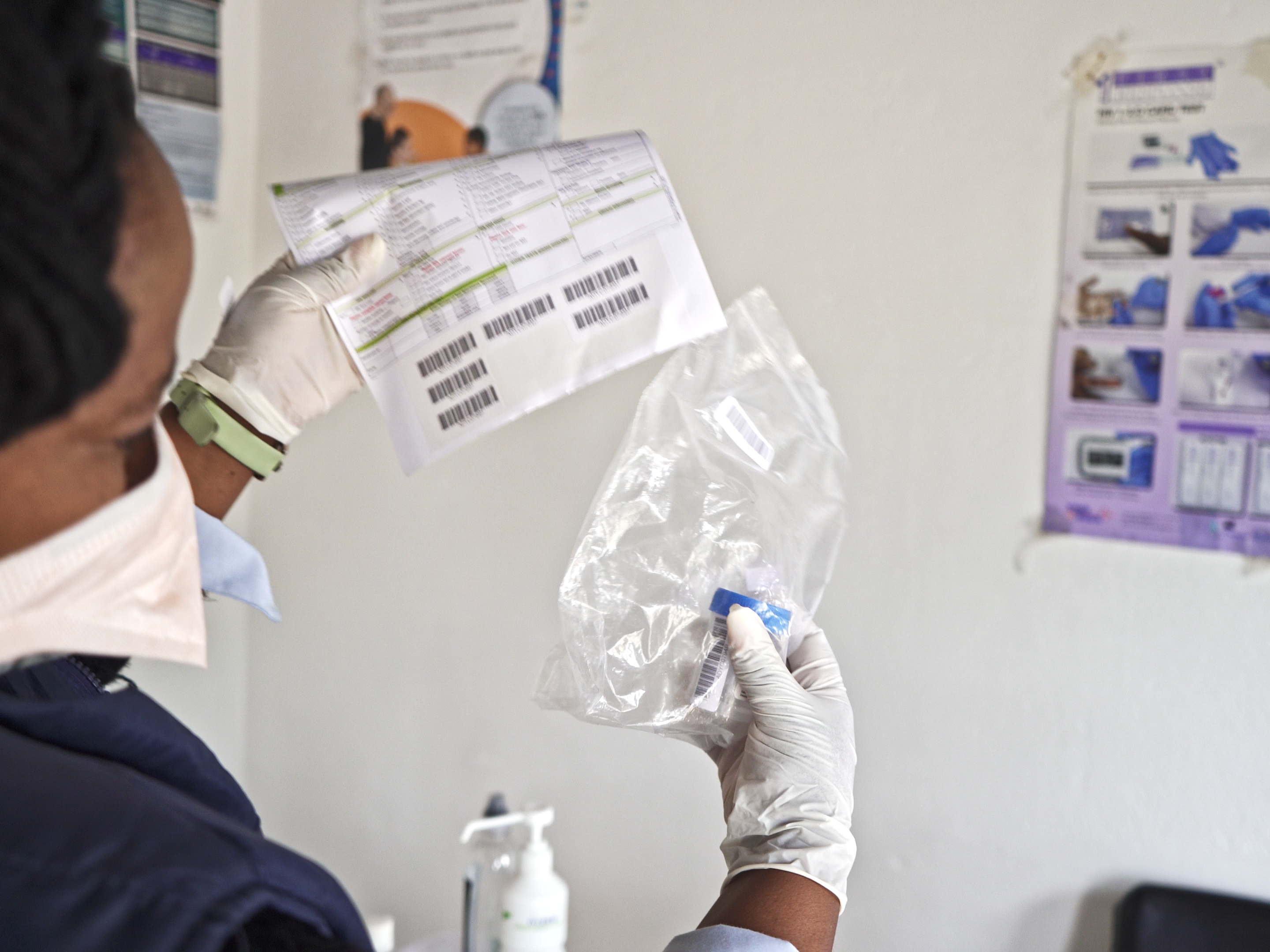 Los recortes en la financiación de EE. UU. amenazan 39 centros de investigación en Sudáfrica y ponen en riesgo los avances contra la tuberculosis y el VIH
