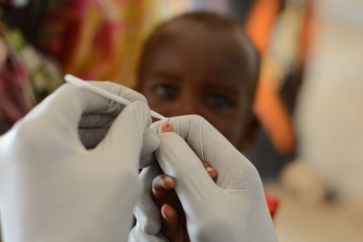 A malaria checkup is conducted on a child in the ER department at the MSF clinic in Zamzam Camp, North Darfur, to monitor symptoms and start treatment if necessary. Zamzam camp near El-Fasher | 30/08/2024 | Photographer: Mohammed Jamal.