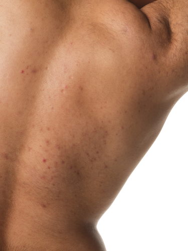 2024-03-12-ORD-BodyCare-Human-BodyScape-NoProduct-E-02 2024-03-12-ORD-BodyCare-Human-BodyScape-NoProduct-E-02