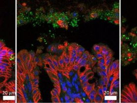 Scientists discover how specific E. coli bacteria drive colon cancer 