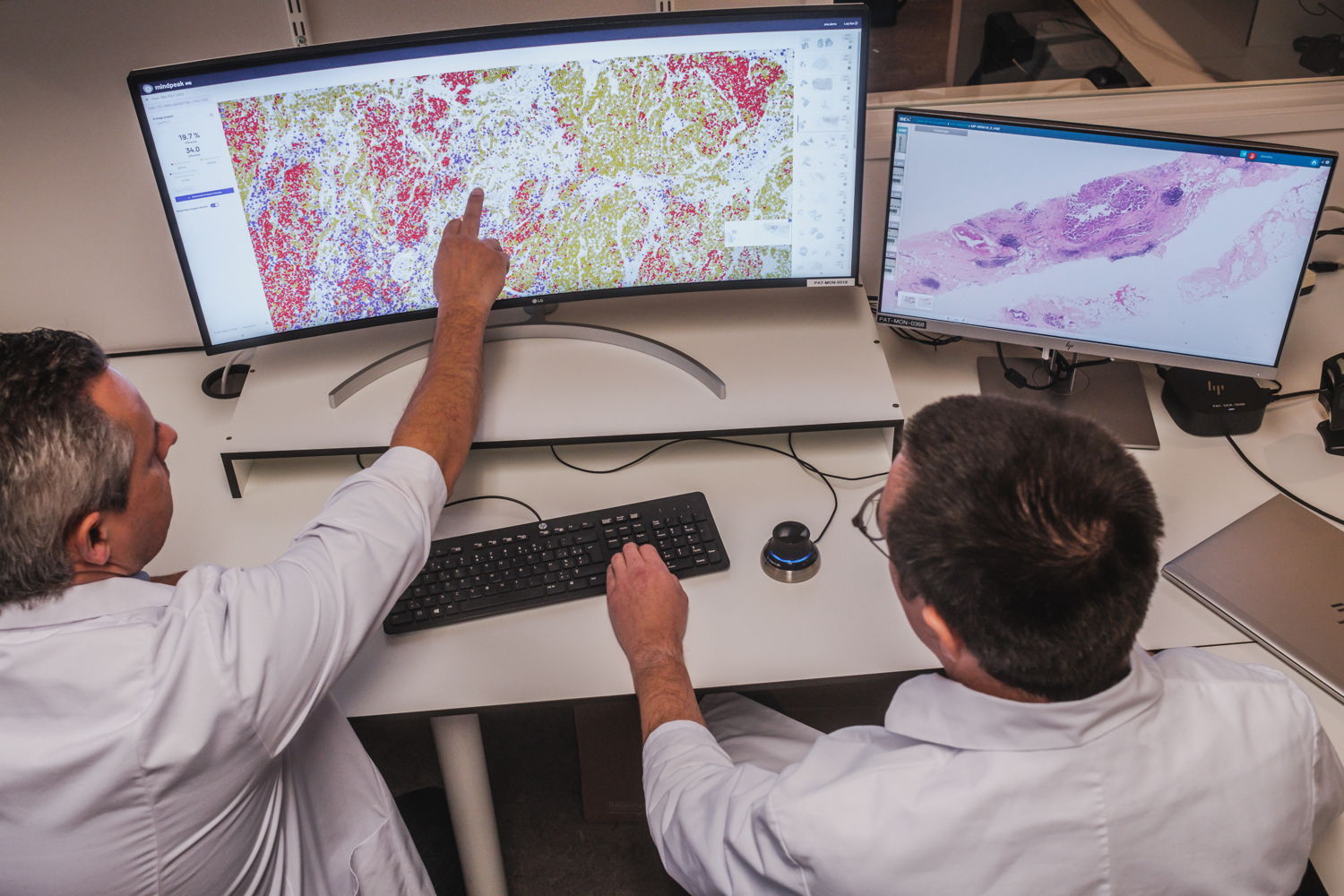 Dankzij artificiële intelligentie (AI) hebben pathologen van Ziekenhuis aan de Stroom (ZAS) 17 procent sneller een eerste onderzoeksresultaat van een tumorstaal.(Foto: ZAS / Lensmens)