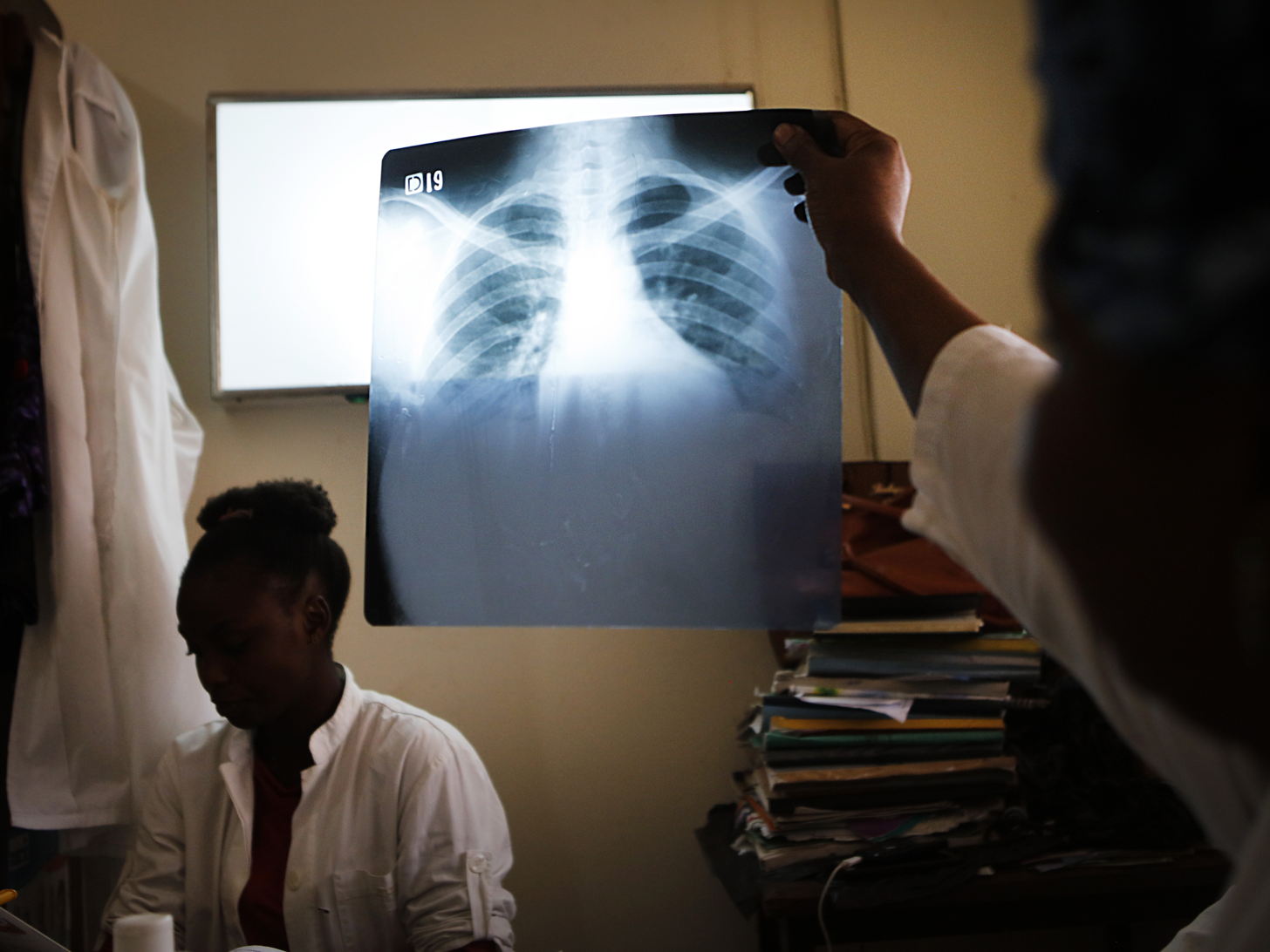 Journée mondiale de lutte contre la tuberculose : 1,25 million de décès chaque année, une urgence sanitaire mondiale