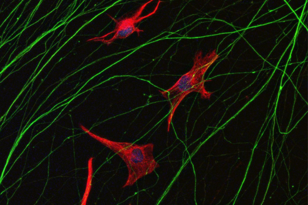 Researchers identify new potential therapeutic target for ALS