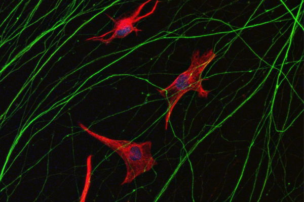 Human induced pluripotent stem cell (iPSC)-derived motor neurons (in green) co-cultured with iPSC-derived astrocytes (in red).