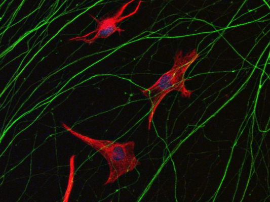 Researchers identify new potential therapeutic target for ALS