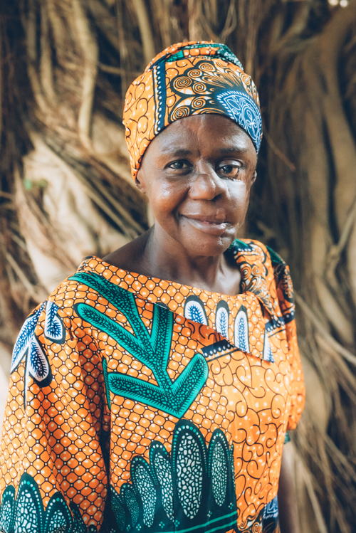 Mulikat Okanlawon, a 38-year-old noma survivor, underwent several reconstructive surgeries and still needs regular follow-up cares for her left eye. She recently cofounded Elysium, the first noma survivors’ organisation. ‘There is ability in disability and there is nothing that we cannot do.’ Sokoto, Nigeria. Photographer: Fabrice Caterini. Date: 07/05/2023. Location: Nigeria Mulikat Okanlawon, a 38-year-old noma survivor, underwent several reconstructive surgeries and still needs regular follow-up cares for her left eye. She recently cofounded Elysium, the first noma survivors’ organisation. ‘There is ability in disability and there is nothing that we cannot do.’ Sokoto, Nigeria. Photographer: Fabrice Caterini. Date: 07/05/2023. Location: Nigeria