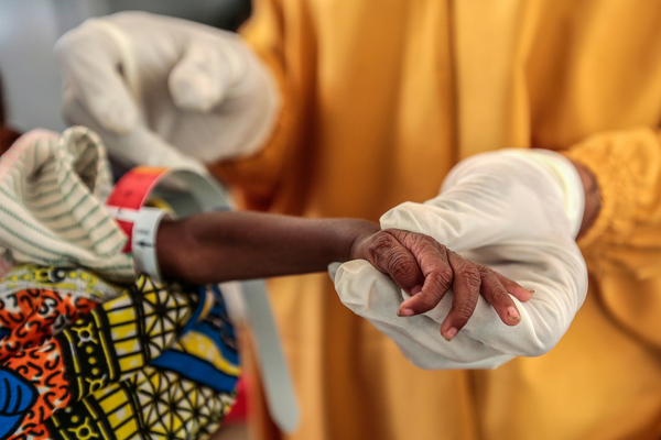 MSF pide a la ONU que reconozca la crisis de desnutrición de "emergencia crítica" en el noroeste de Nigeria