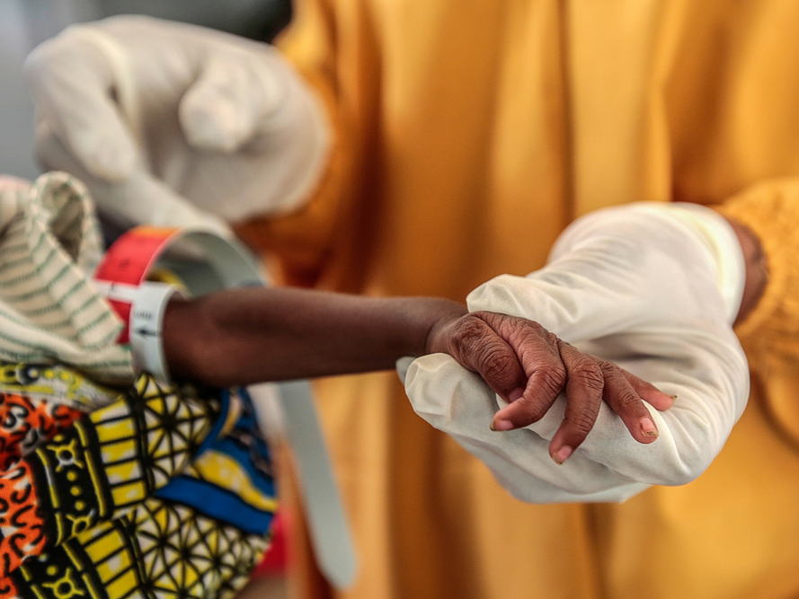 MSF pide a la ONU que reconozca la crisis de desnutrición de "emergencia crítica" en el noroeste de Nigeria