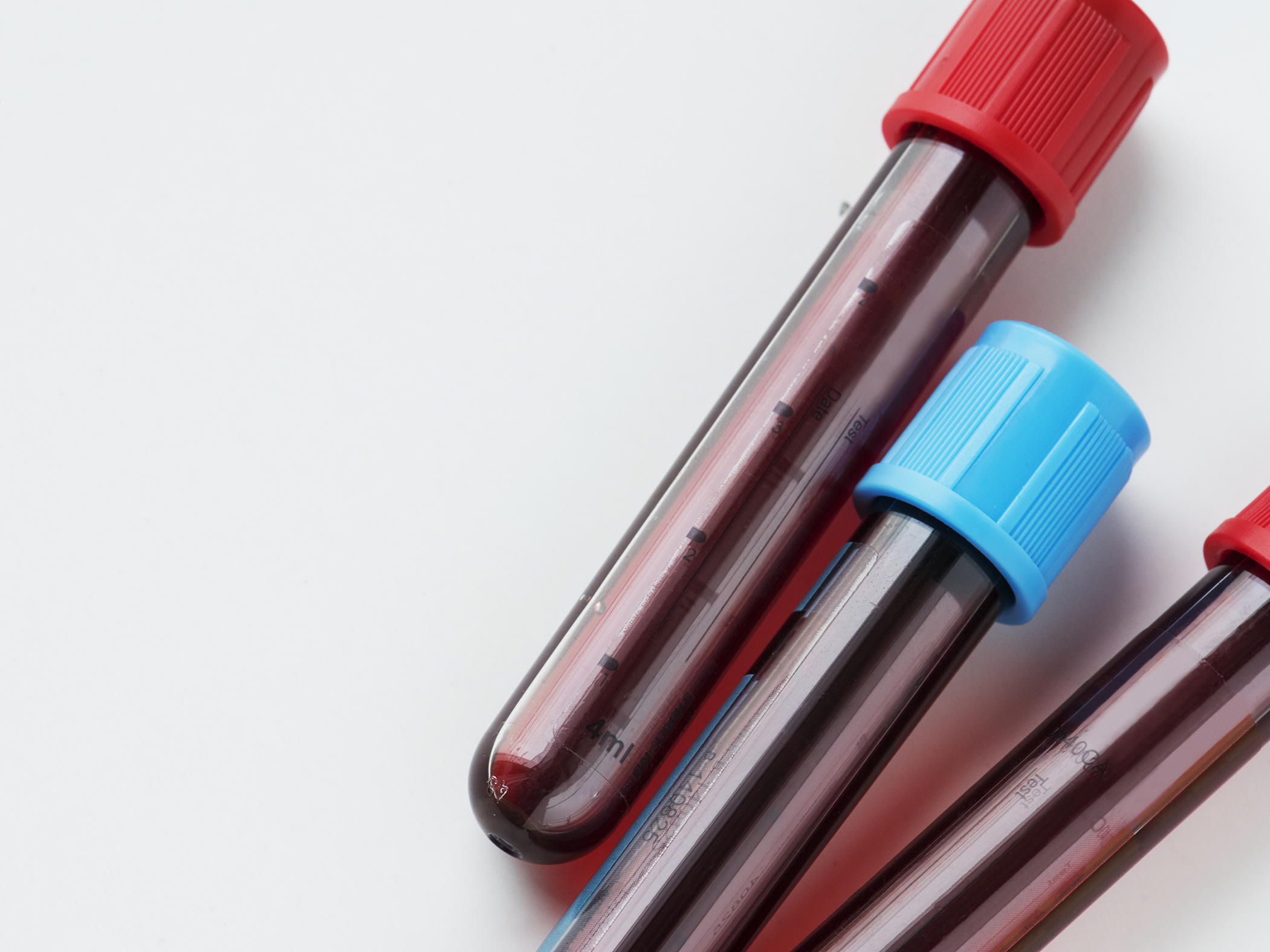 Medewerkers spoed en intensieve zorg ZNA niet méér blootgesteld aan virus