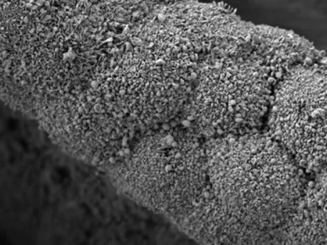 "The next step was to see if changing the intestinal bacteria composition could have a positive effect on Parkinson's disease"