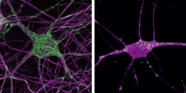 Muizenneuronen (links) en een menselijke neuron (rechts). Mitochondriën in het groen.