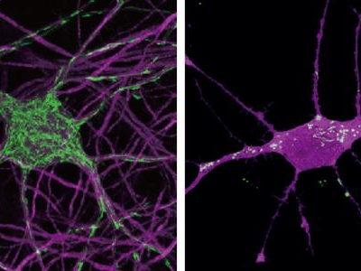 Le secret de la lente croissance du cerveau humain