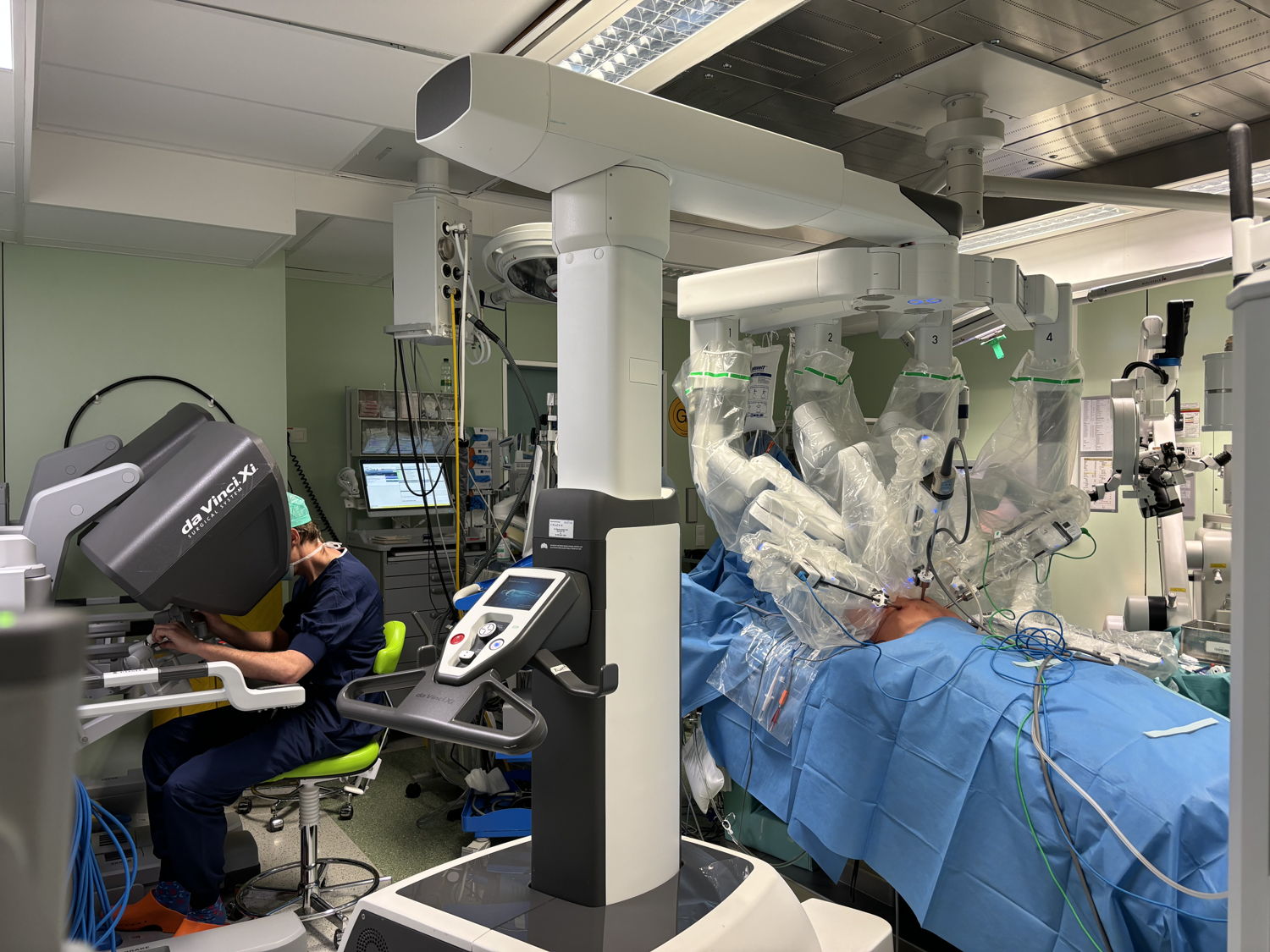 Dr. Dr Martijn Schoneveld operates the Da Vinci XI robot to remove a piece of the peritoneal fold.