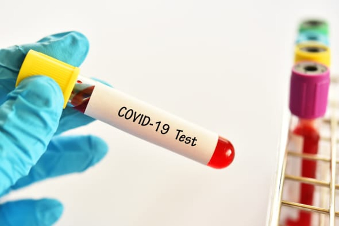 Jan Yperman Ziekenhuis en Voka West-Vlaanderen testen medewerkers op Covid-19