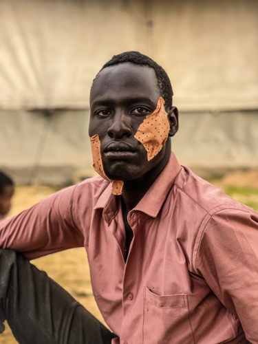 No one was allowed to go in or out. People tried to get clean water from some wadis or springs, but snipers were shooting at them. At the beginning there was a resistance by Masalit armed groups, but they could not hold. N. 25 years old. Copyright MSF