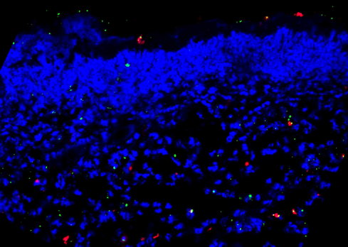 Dendritic cells (red) clearing death cells (green) in skin wounds in mice