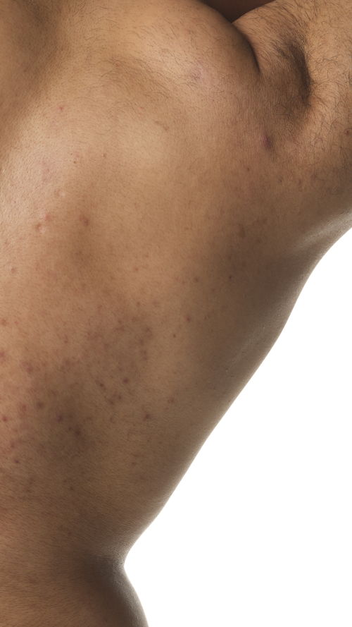 2024-03-12-ORD-BodyCare-Human-BodyScape-NoProduct-E-02-16x9 2024-03-12-ORD-BodyCare-Human-BodyScape-NoProduct-E-02-16x9