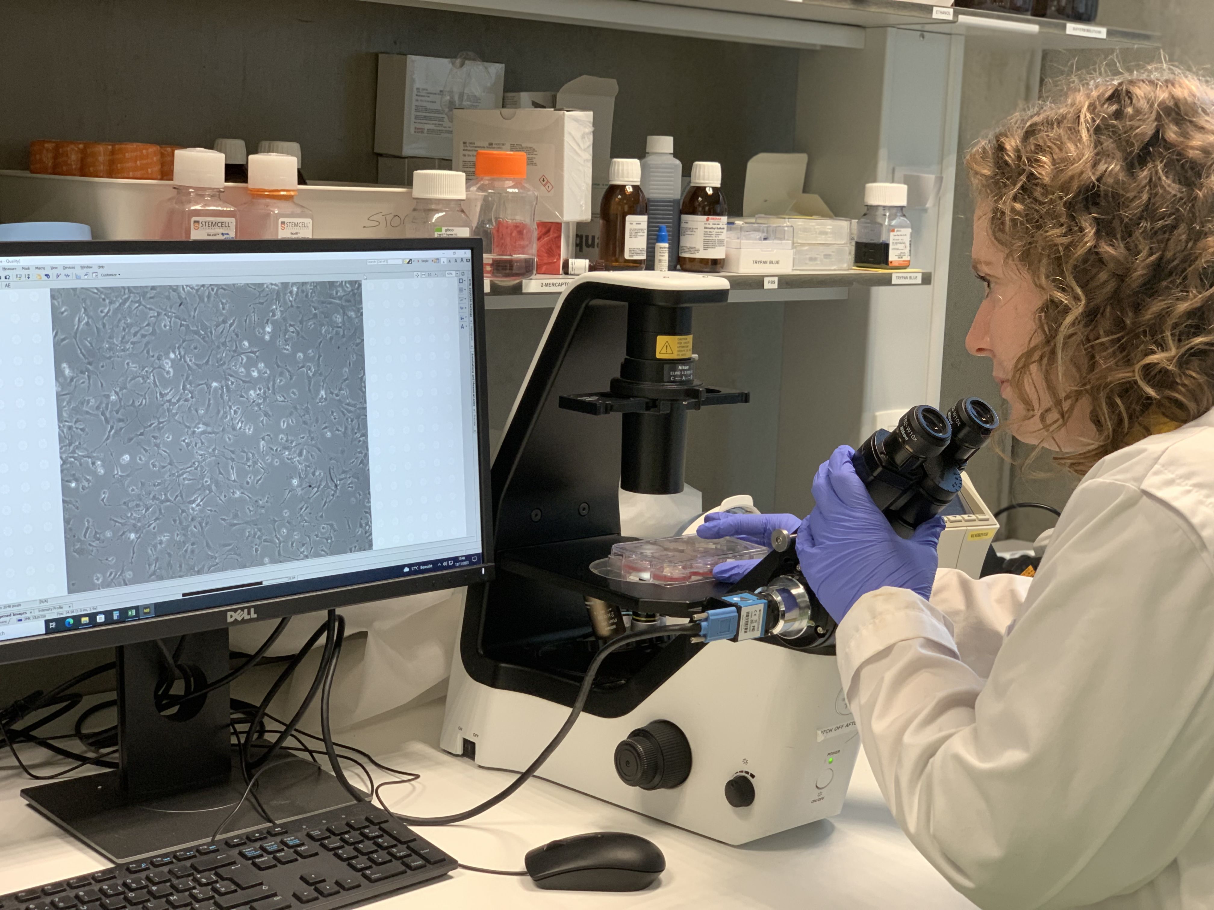Christine Germeys is differentiating astrocytes derived from induced pluripotent stem cells (iPSCs) under the brightfield microscope in the Van Den Bosch lab.