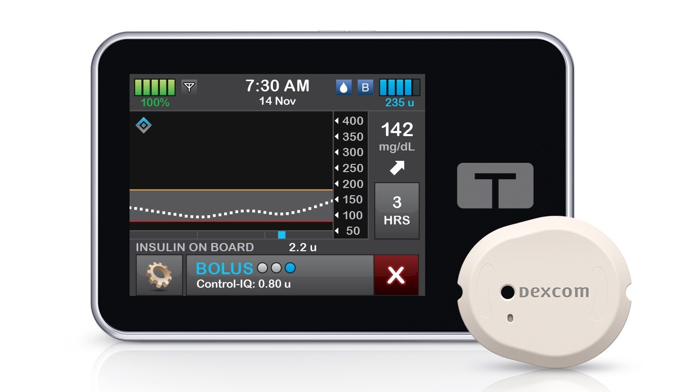 Le Dexcom G7 peut désormais être connecté à la pompe à insuline Tandem t:slim X2