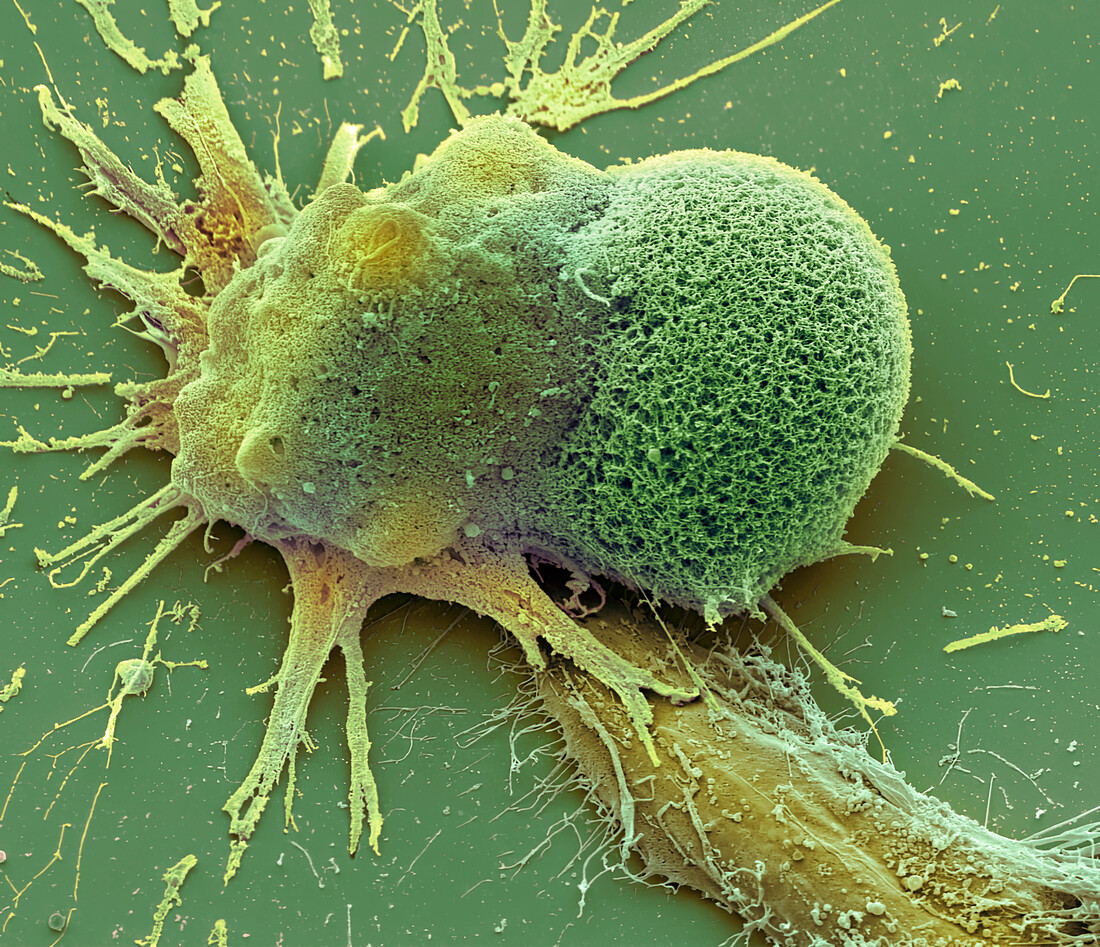 Steve Gschmeissner / Science Photo Library / Sucré Salé
