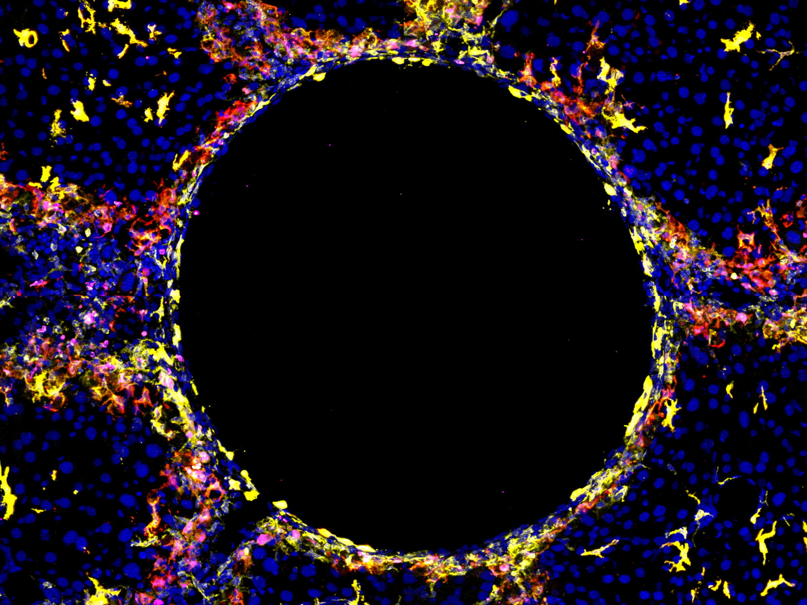 Specific types of liver immune cells are required to deal with injury
