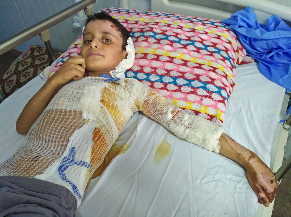 Slachtoffer clusterbom in Irak © Elisa Fourt / Handicap International
