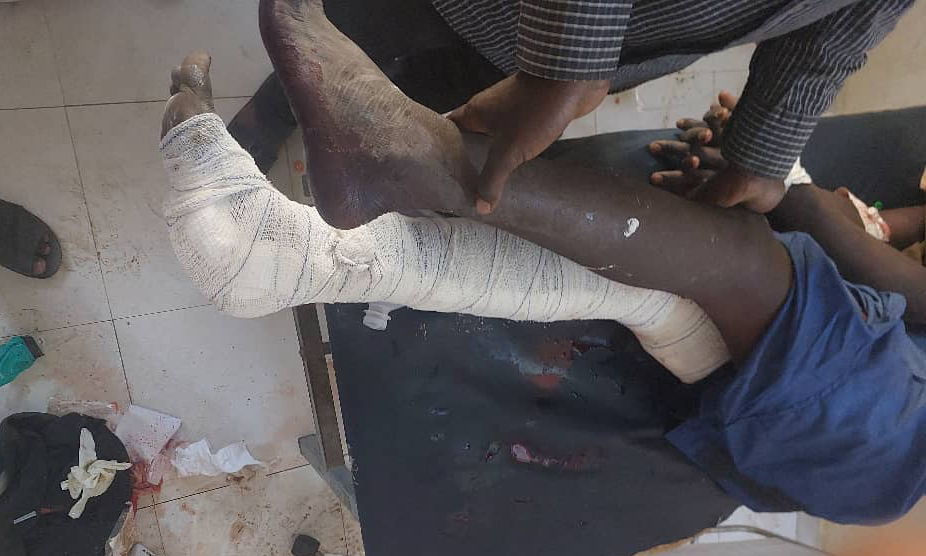 A patient in the MSF supported Nyala Teaching Hospital receives treatment for injuries caused by airstrikes on 3 February 2025 | Date taken: 04/02/2025 | Copyright: MSF | Location: Sudan