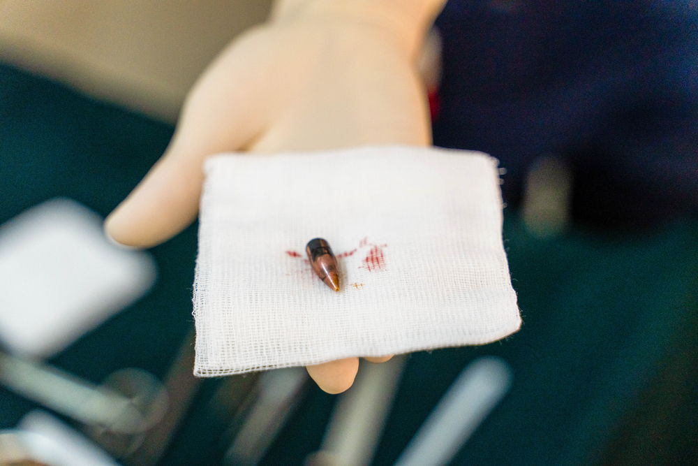 A bullet extracted from a patient. Bullet wounds are one of the most common cases treated at Bashair hospital on a daily basis. | Date taken: 13/05/2023 | Photographer: Ala Kheir