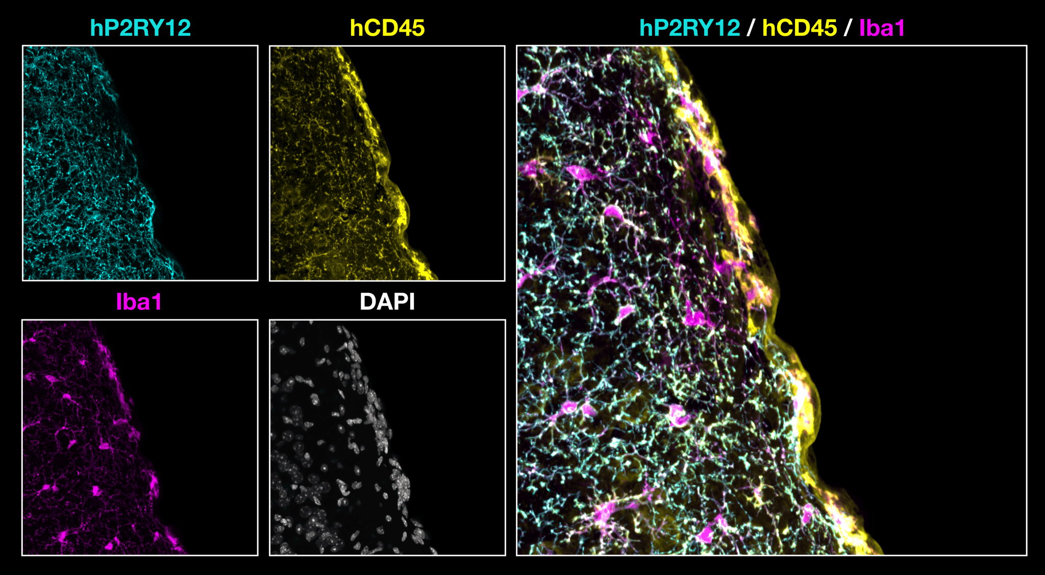 Brain sections with human meningeal macrophages (Martinez-Muriana et al. 2026)