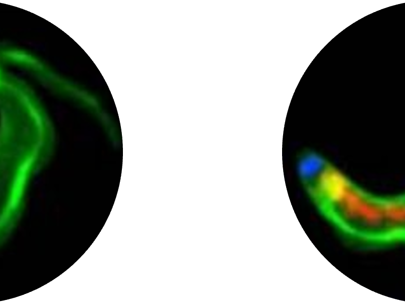 Newly discovered protein blocks sleeping sickness 