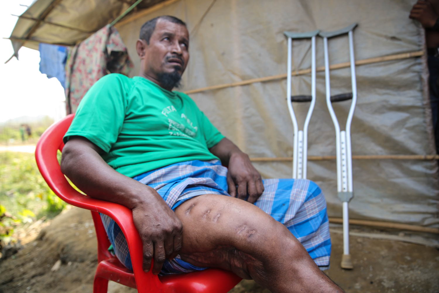 Tasnimarkhola camp: Rohingya refugee Mohammad Younis, 60, was shot by the Myanmar army in 2016. Credit: Mohammad Ghannam/MSF