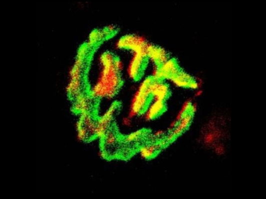 Baanbrekend Onderzoek Biedt een Nieuwe Aanpak ter Verbetering van Neuromusculaire Functie bij Patiënten met de Ziekte van Duchenne