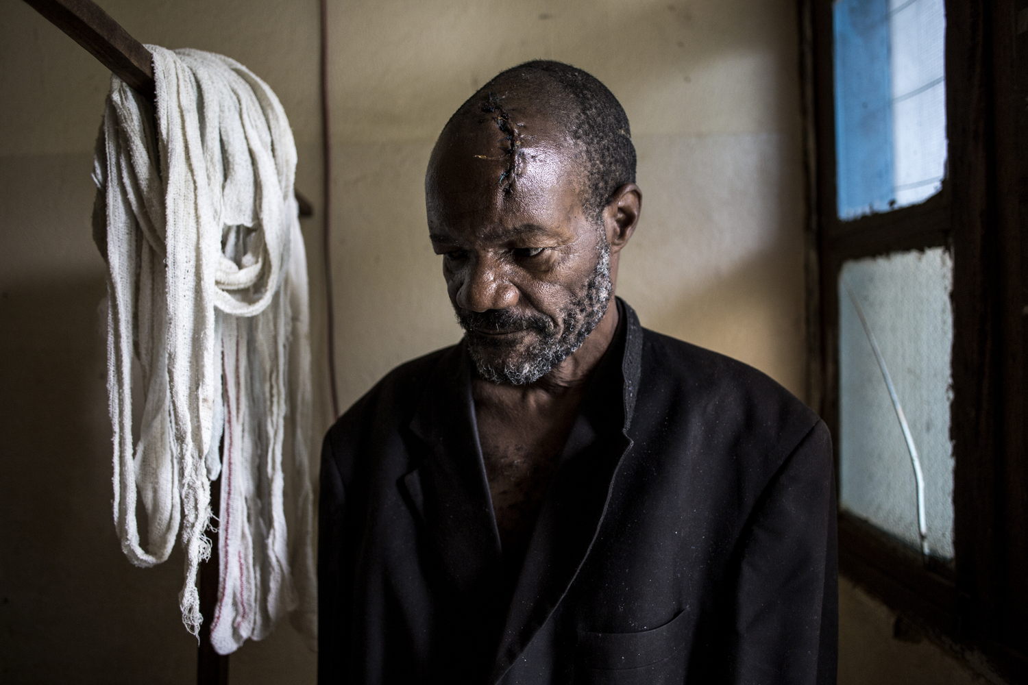 Bawma Yoame (56), recovers in a hospital room on 2 March 2018 in Bunia, after an attack on his village left him severely wounded with multiple lacerations to the head. ©John Wessels/MSF