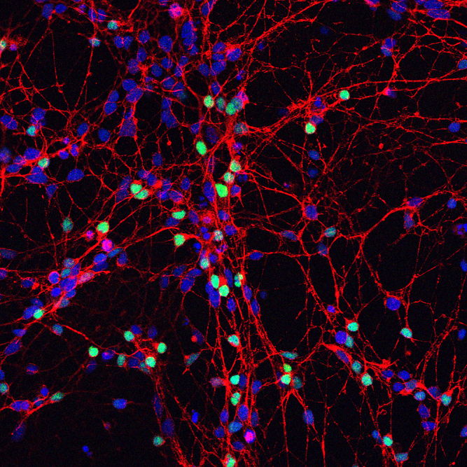 hiPSC-derived cortical neurons 