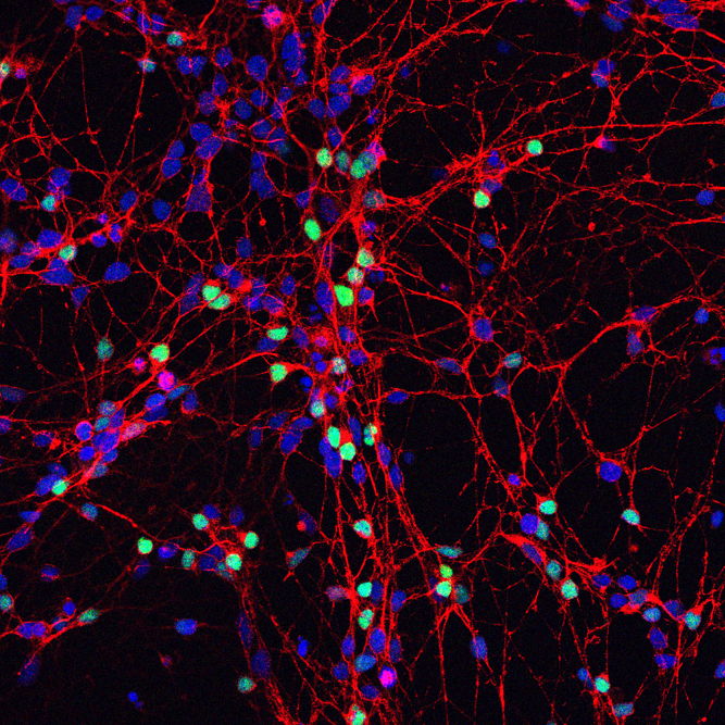 Neuronen van humane stamcellen